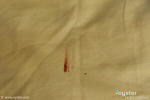 Bloody sheets (?) at Negril Escape Resort and Spa